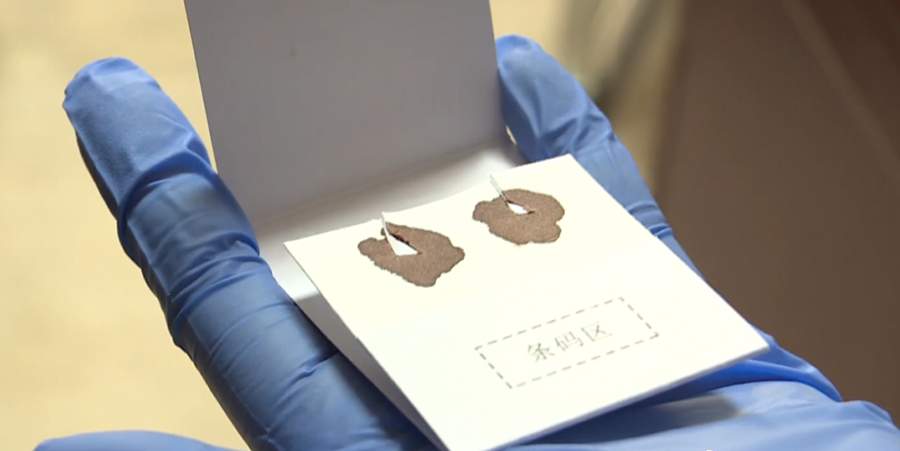 沈阳哪家医院能办理亲子鉴定,