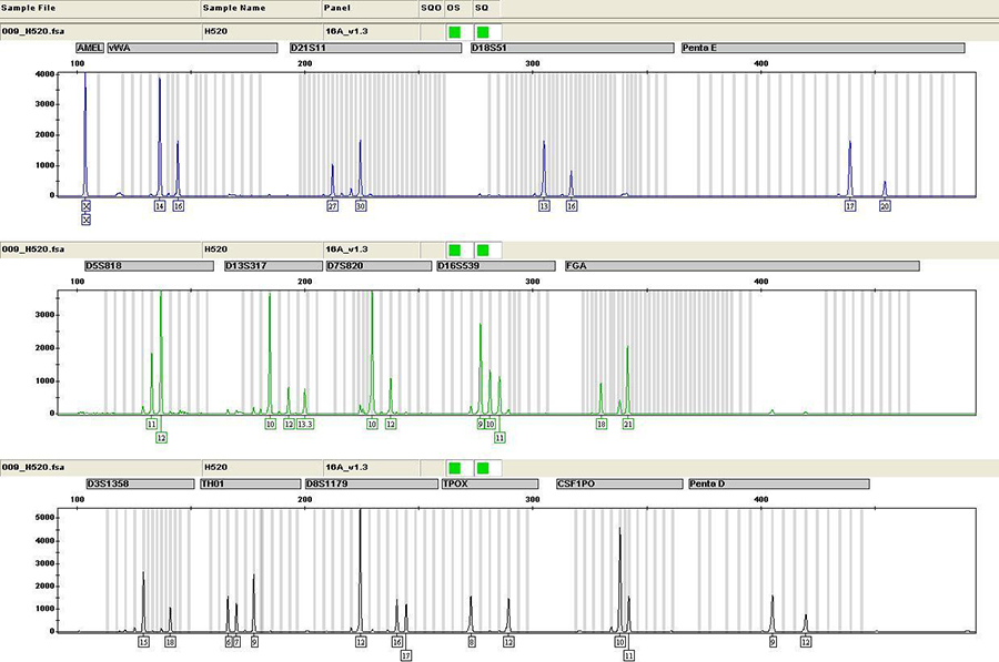 沈阳哪家医院可以做亲子鉴定呢,沈阳医院做DNA亲子鉴定的流程