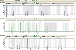 沈阳司法DNA亲子鉴定哪里可以做(咨询地址)