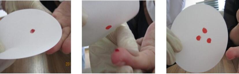 血痕样本采集操作方法